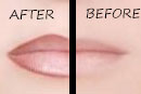 Permanent Lips
